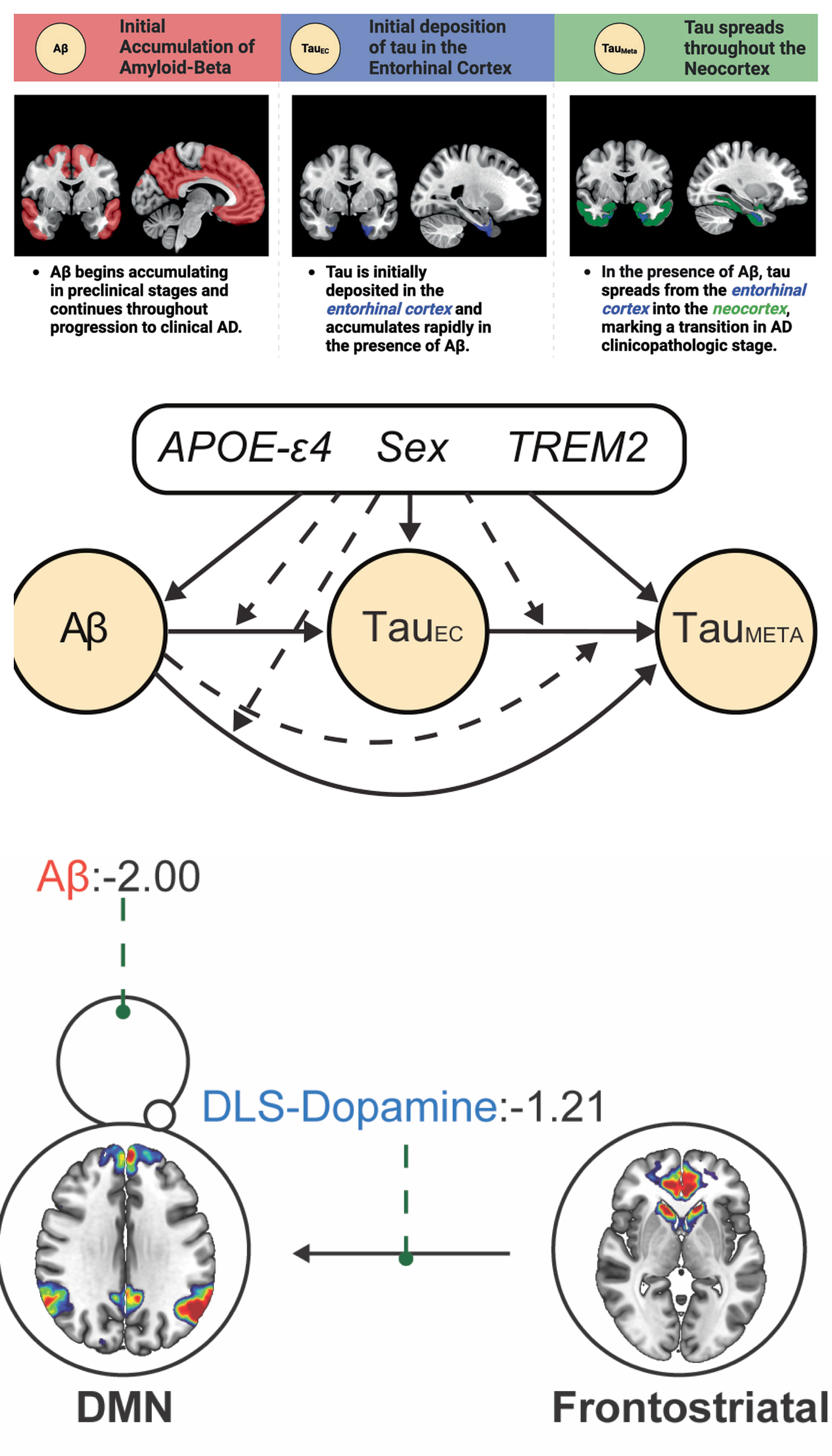 The canonical Alzheimer’s disease cascade from amyloid to entorhinal tau to neocortical tau with a path diagram of how APOE-ε4, sex, and TREM2 act on each stage; below it, amyloid acting on the default mode network and frontostriatal dopamine modulating that network